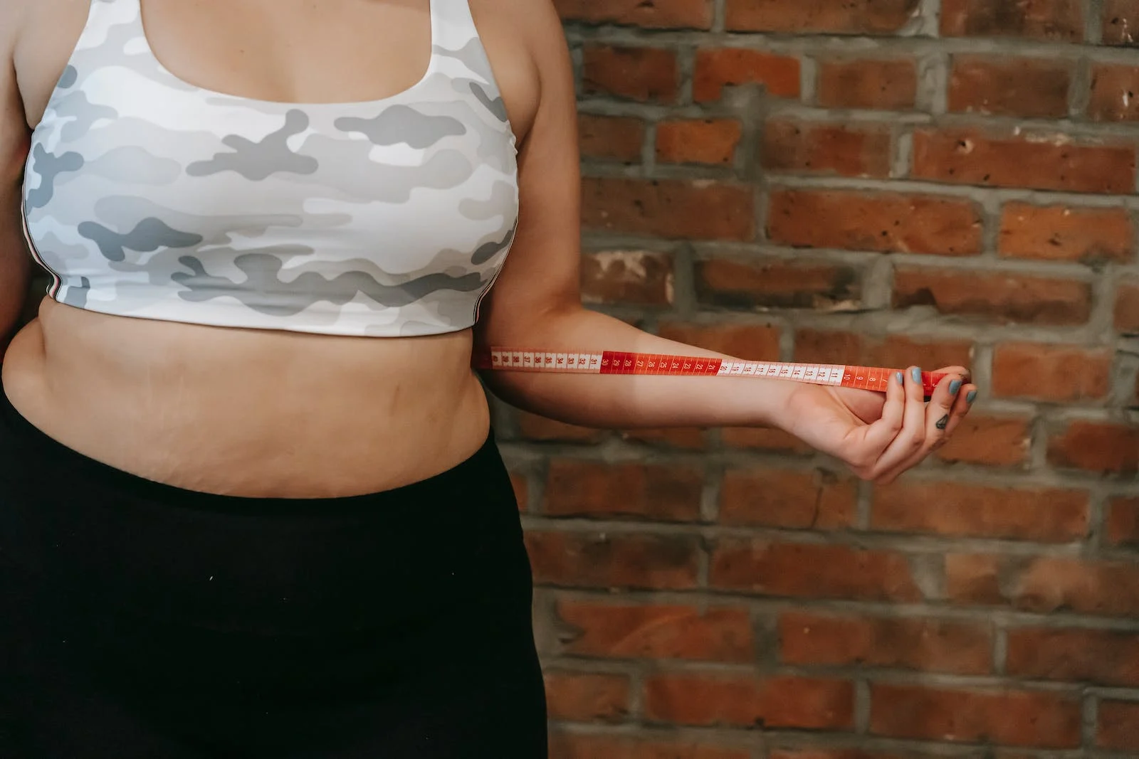 Understanding Diabesity: Key Concepts and Related Terms